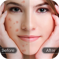 Face Blemish Remover Logo