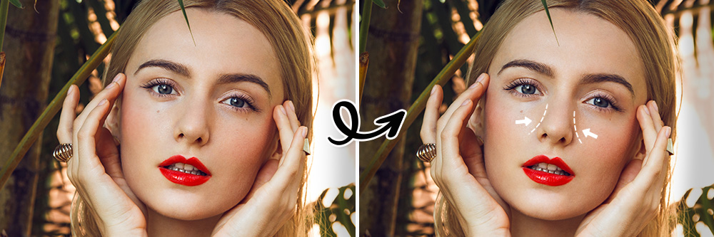 Virtual Rhinoplasty Simulator Try The Best AI Nose Job Filters