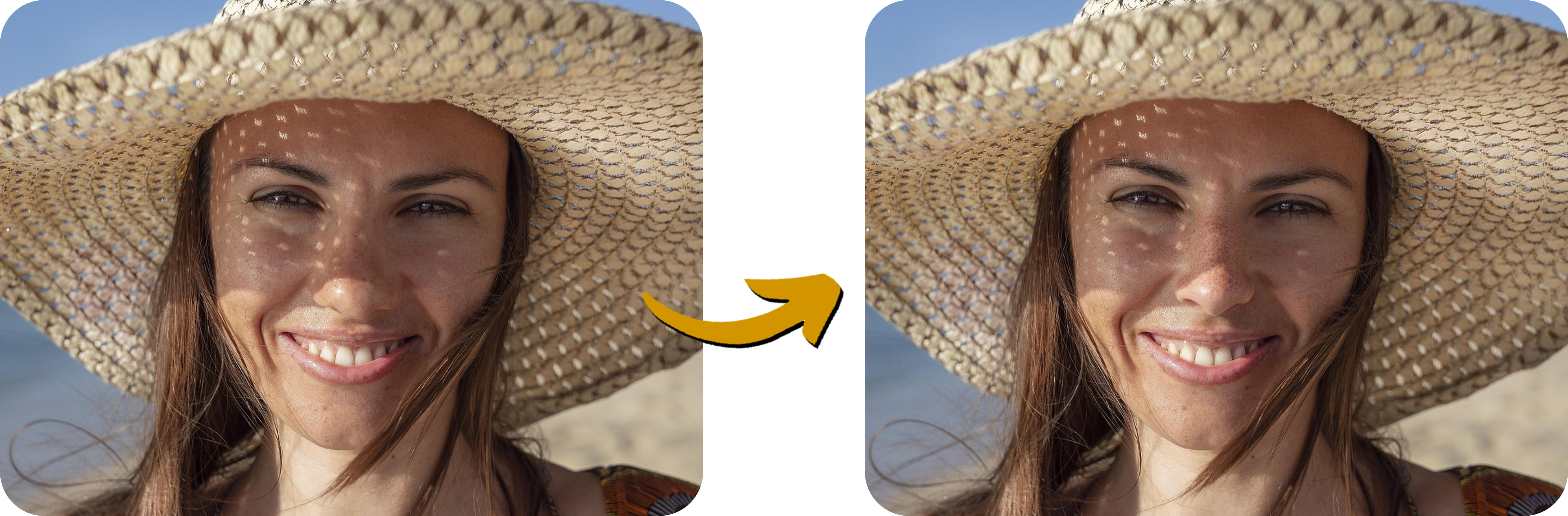 simulador de rinoplastia