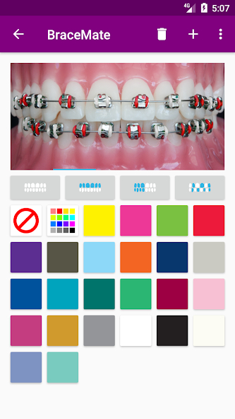 BraceMate App
