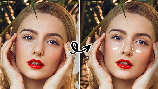 Plastic Surgery - Nose