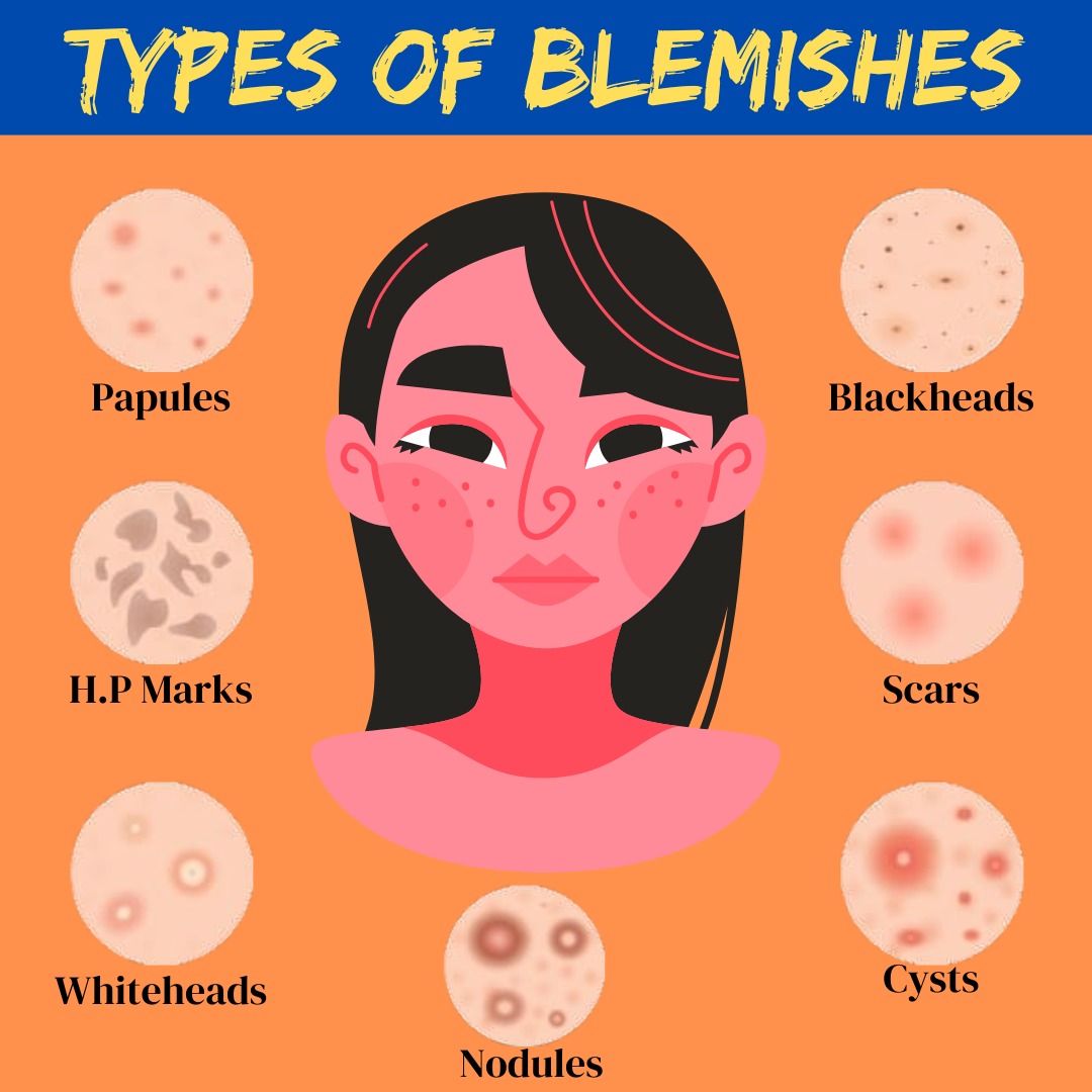 Types of Blemishes