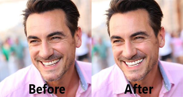 Comparison of Teeth Whitening of PhotoDirector