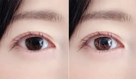 目の明るさ